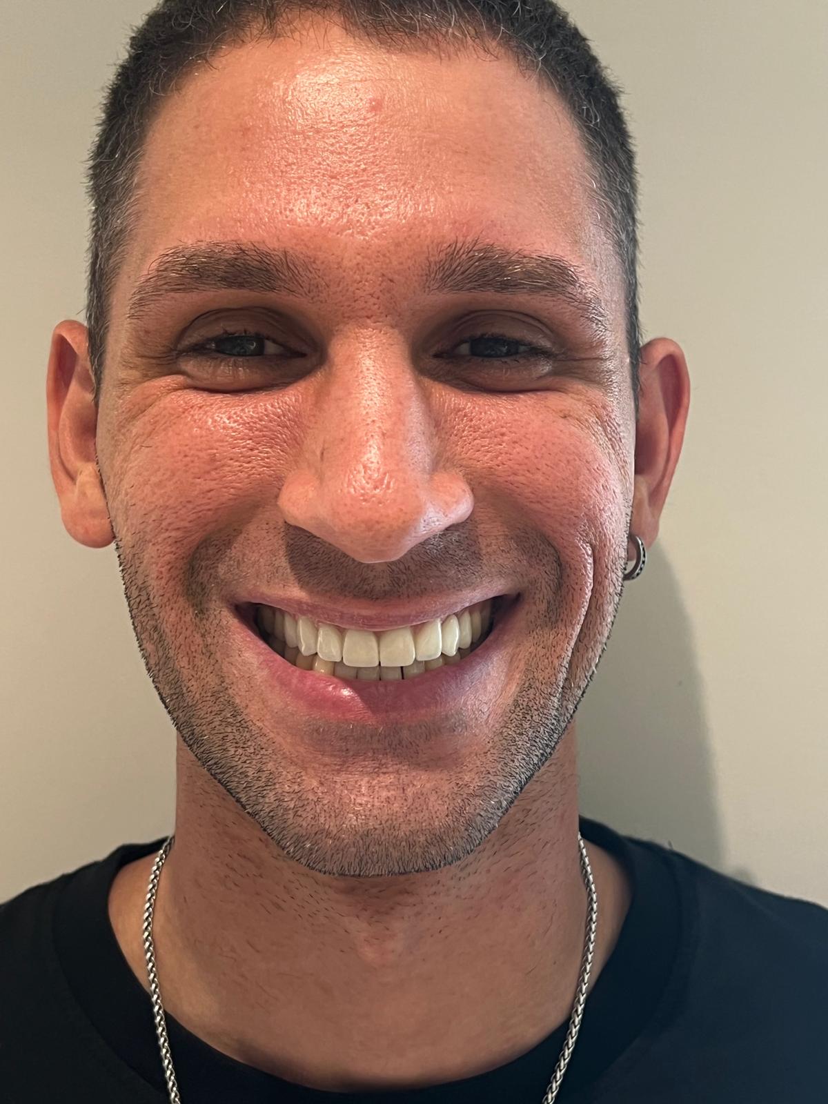 ECE Dental Patient Transformation